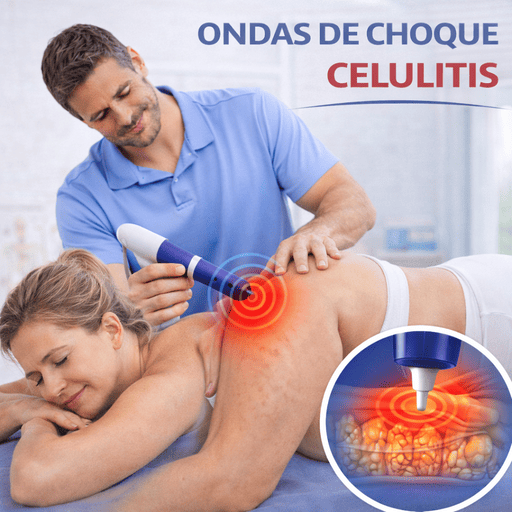 ondas de choque celulitis